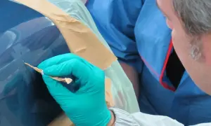Mann mit Handschuh entfernt Rost von Autolack. Sorgfältige Arbeit, um das Auto entrosten.